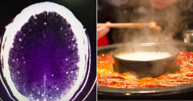 Hot pot