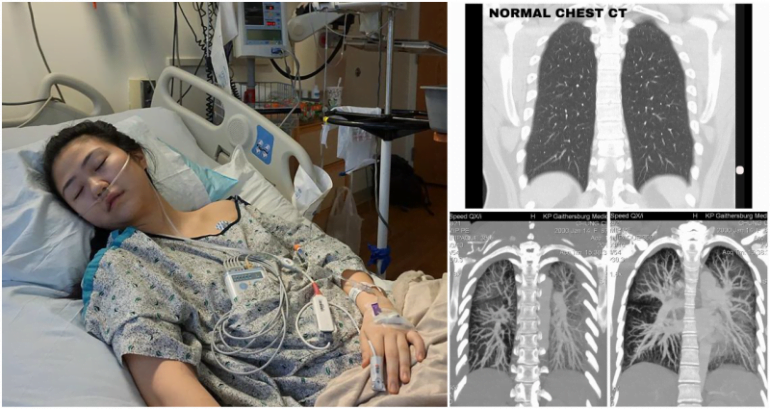 Teen Shares Heartbreaking Instagram Post About the Dark Realities of Vaping