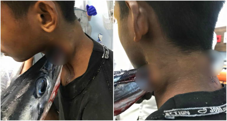 Fish in Indonesia Apparently Jump Out and Stab You in the G*ddamn Neck