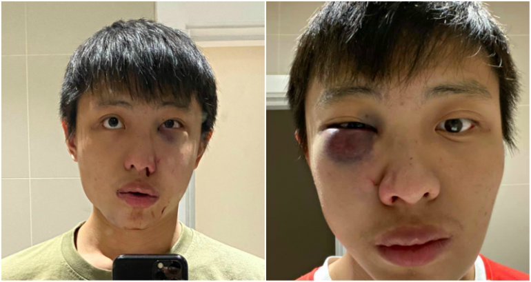 UK Teen Sentenced to 18 Months ‘Youth Rehab’ for Racist ‘Coronavirus’ Attack on Singaporean Student