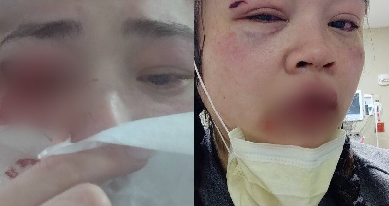Dallas train assault