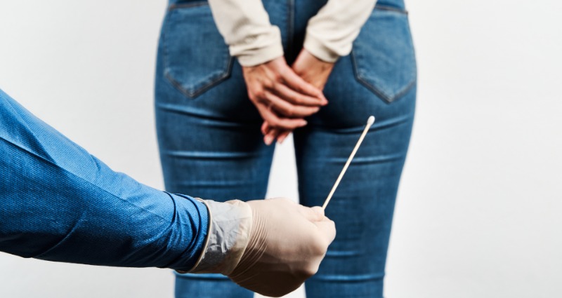 anal swab tests