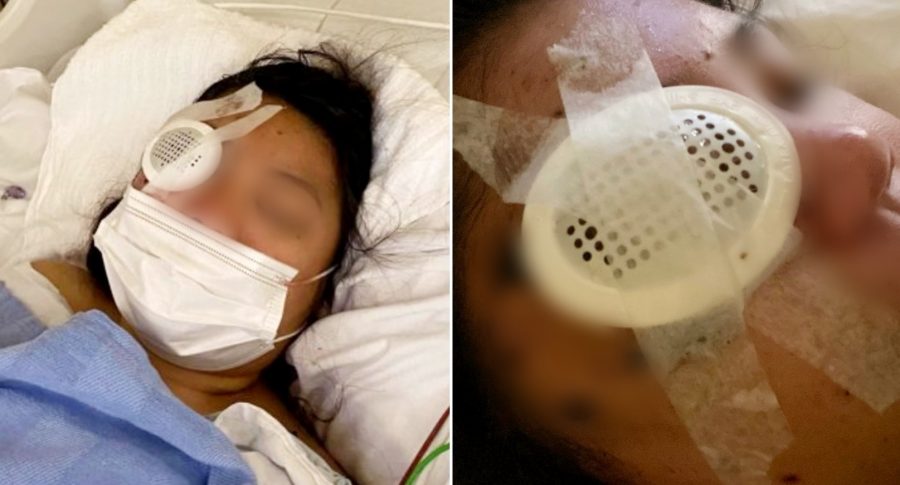 Bay Area Teen Shot Through Her Eye in a ‘Hate Crime,’ Family Says