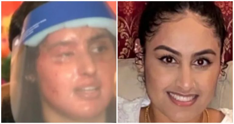 Pakistani College Student Speaks Out, Police Seek Suspect After Acid Attack in NY