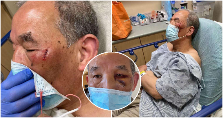 68-Year-Old Man Suffers Nightmares After Attack in Oakland