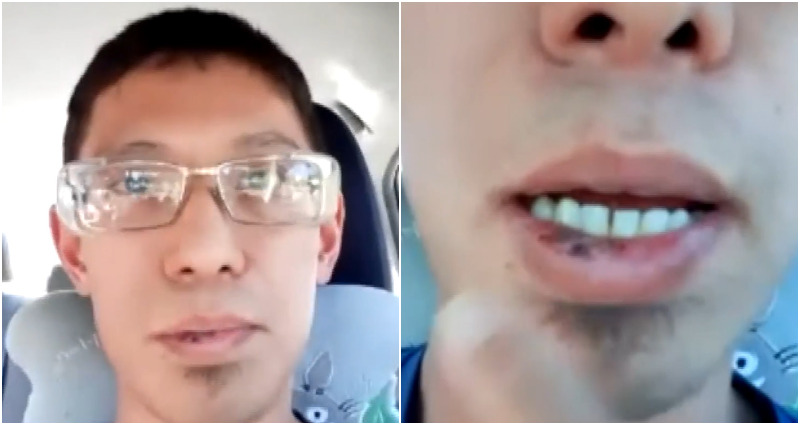 Man Suffers Cuts and Bruises After Getting Shot With PAINTBALLS in Sacramento