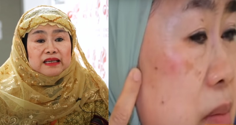 Indigenous Filipina nurse attacked