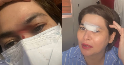 Aiko Melendez spicy korean ramen accident