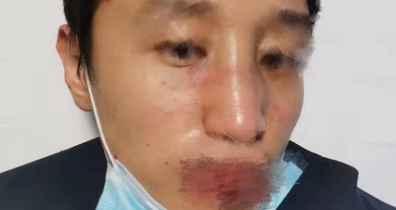 Chinese man brutally beaten by mob of racist teens starts petition to Stop Asian Hate in Cambridge