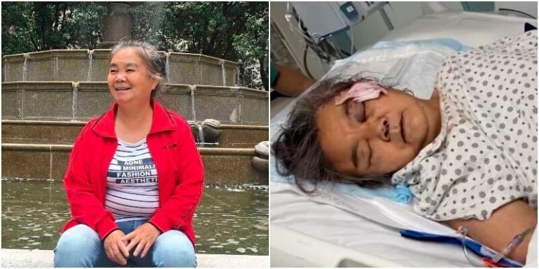 Elderly Asian woman in critical condition after being struck with large rock in NYC