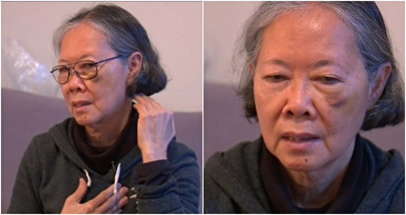 brooklyn asian woman punched