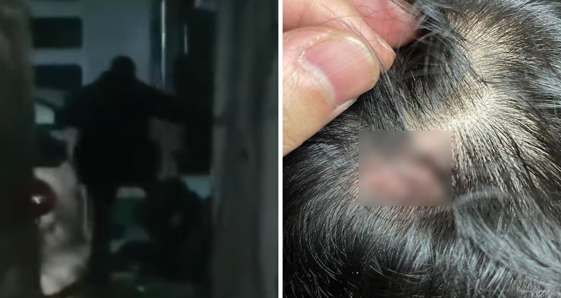 chinese student attack