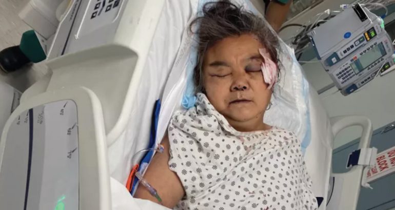 GuiYing Ma, grandmother struck in the head with a rock outside her Queens home, has died