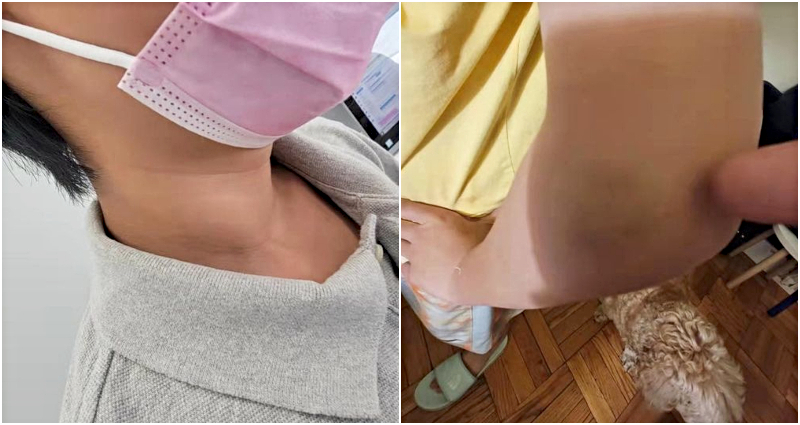 EMMA ASSAULT NYC