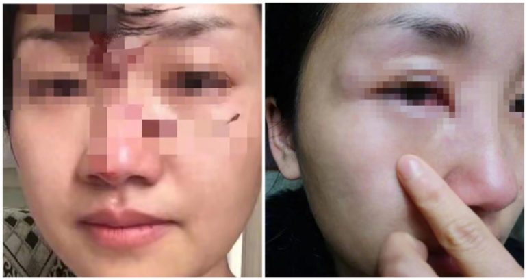 University in China bans professor whose wife alleges he beat her over 1,000 times