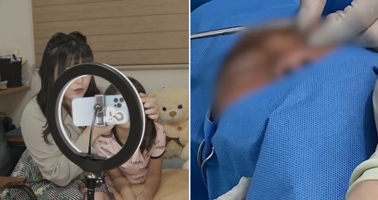 Japanese mom has her 9-year-old daughter undergo double eyelid surgery to be ‘beautiful’