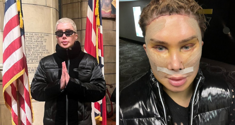 Oli London detransitions from ‘Korean’ woman to British man