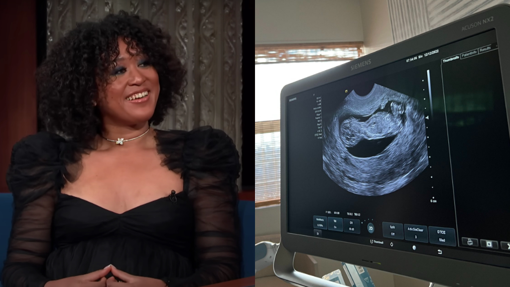 naomi osaka pregnant