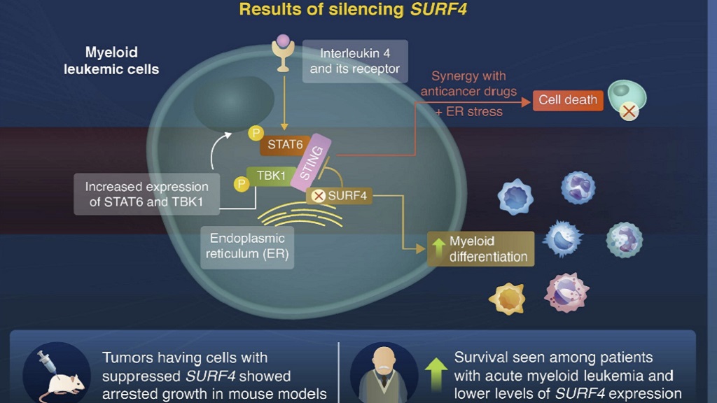 South Korean scientists found a gene that can help regulate leukemia progression