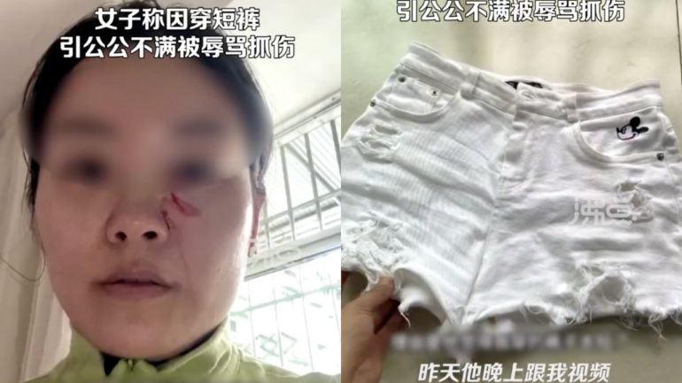 Chinese woman accuses father-in-law of assaulting her with hot soup over length of her shorts