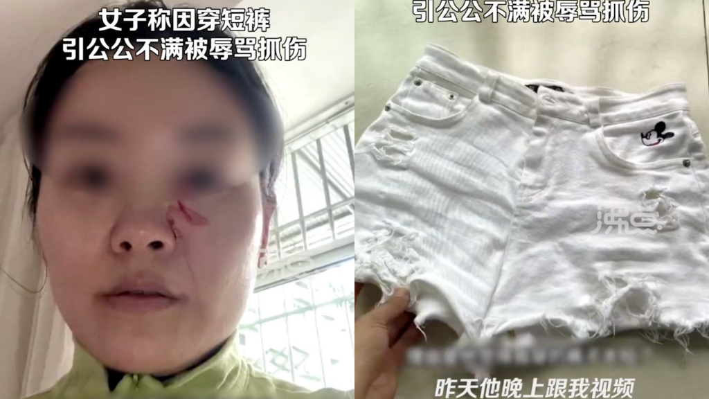 Man assaults daughter-in-law for wearing shorts in summer