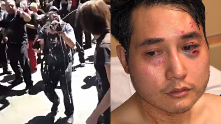 Conservative journalist Andy Ngo wins $300,000 from 2019 milkshake attackers
