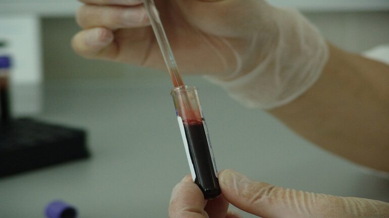 Japanese scientists successfully use artificial DNA to kill cancer cells