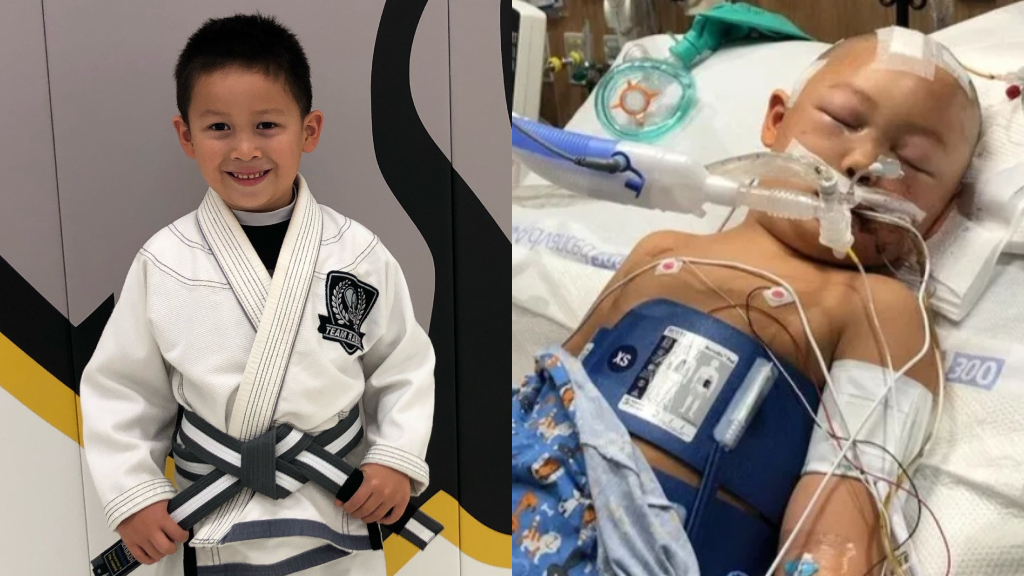 6-year-old fighting for life after Texas man bashed his head with baseball bat
