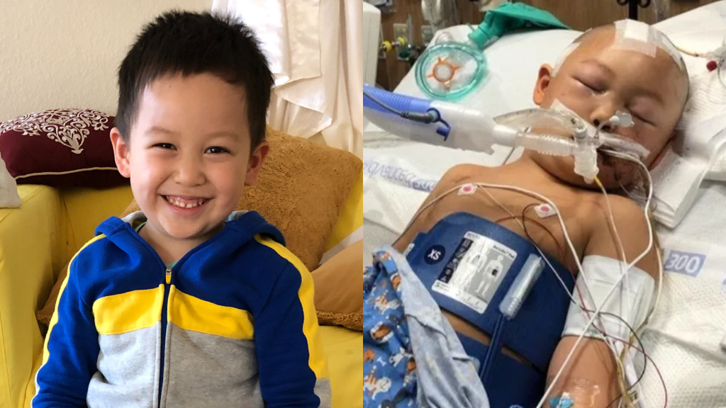 6-year-old attacked with baseball bat stable, makes ‘unexpected progress’