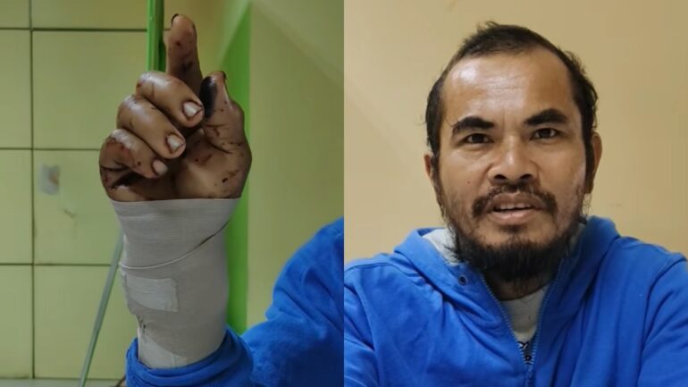 Filipino man fights back python snake by biting it to death