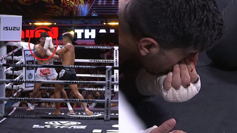 Video: Muay Thai fighter suffers horrific broken nose during match