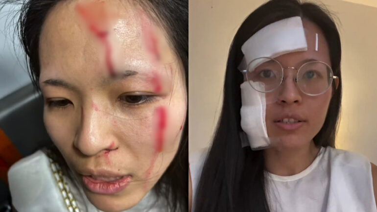 Asian woman ‘needs her city back’ after violent attack in NYC