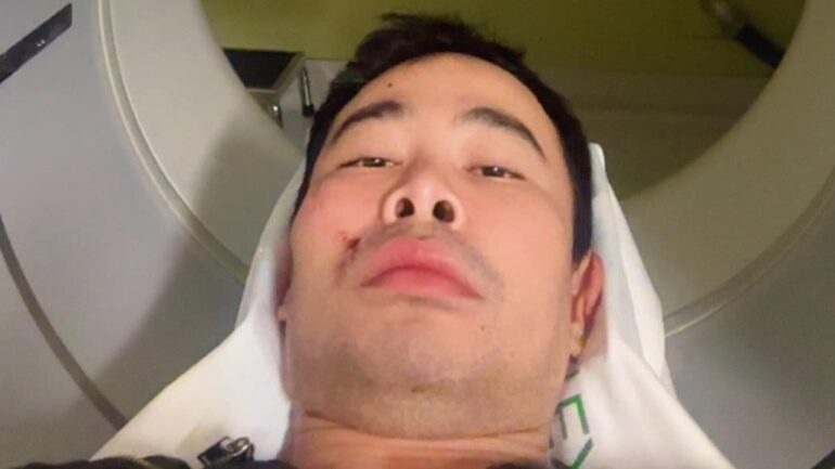 Queer Asian man assaulted in possible hate crime in San Francisco