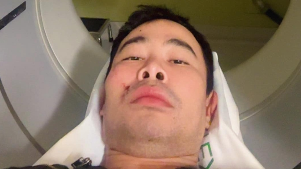 Queer Asian man assaulted in possible hate crime in San Francisco