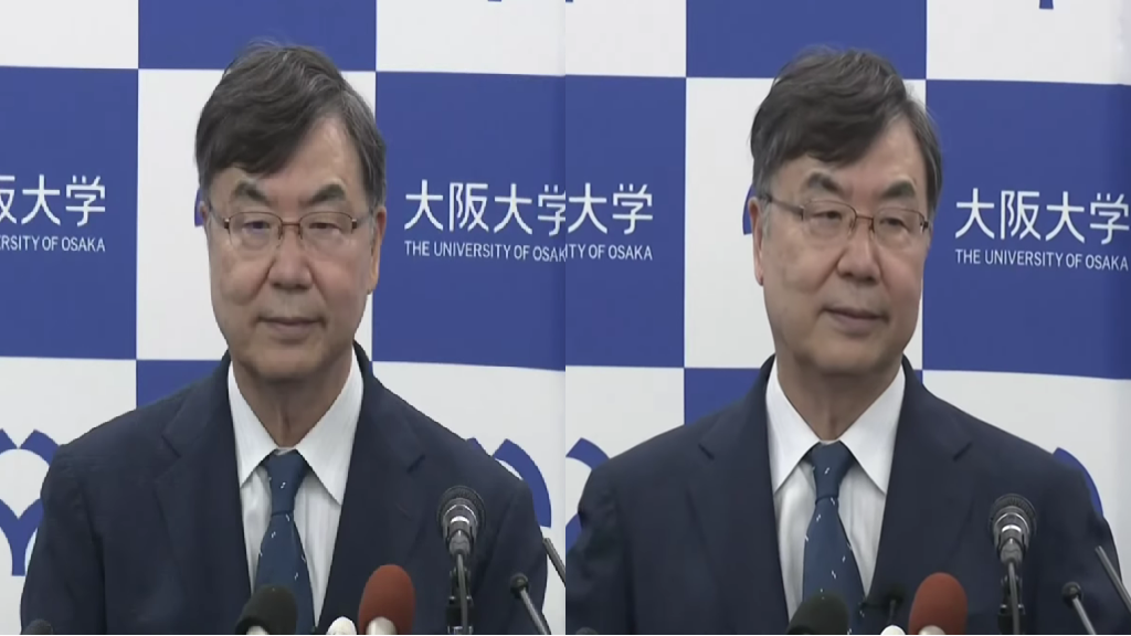 Japanese scientist awarded Nobel Prize for immune tolerance discovery
