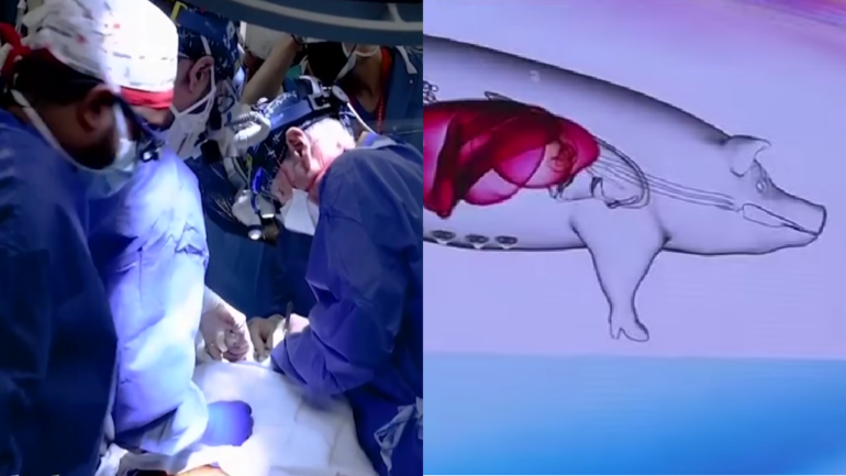 Chinese scientists achieve world’s 1st successful living pig-to-human liver transplant