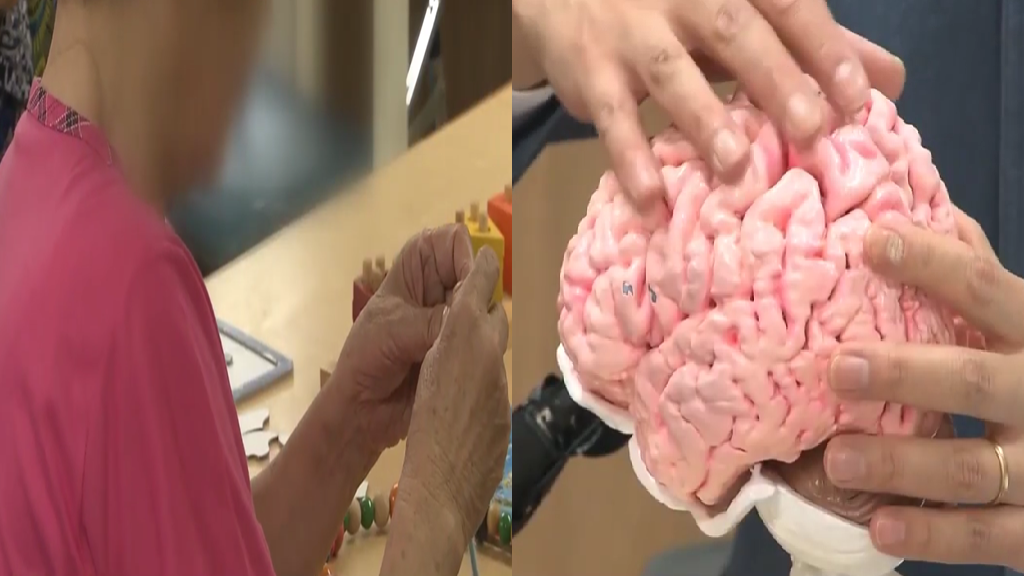 Why Asian American women are more likely to develop dementia than men
